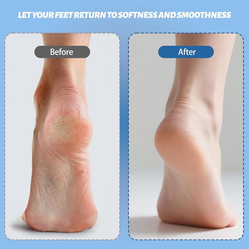 Doeean Electric Feet Foot Callus Remover Equipped with A Vacuum System Foot Scrubber 17 in 1 Professional Foot Care Tool Ipx6 Waterproof Rating for Removing Hard Cracks Dryness and Dead Skin (White) - Image 3